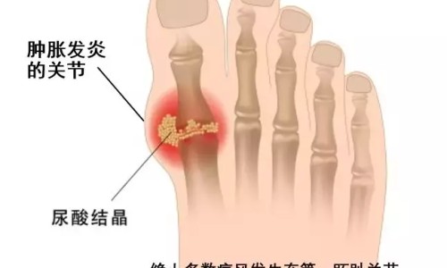 高血压能吃驴胶补血吗-血压低吃驴肉管用吗、血压低吃驴肉管用吗 -低血压可以吃驴胶补血颗粒网